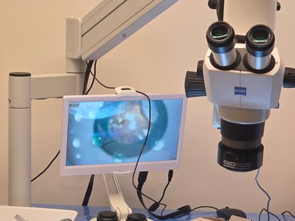 Workshop Ophtalmologie Johnson&Johnson - Session 1